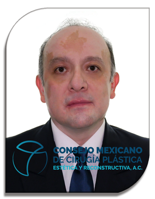 MARTIN PEREZ VASCONCELOS