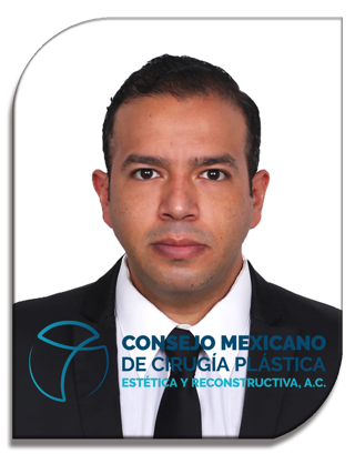 RICARDO CANDELARIO CERVANTES LIMON