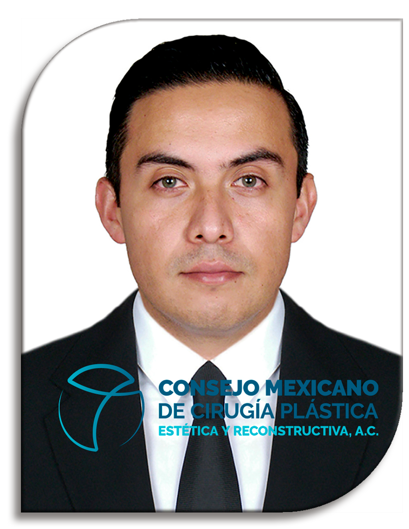 Donovan Reynoso Saldaña
